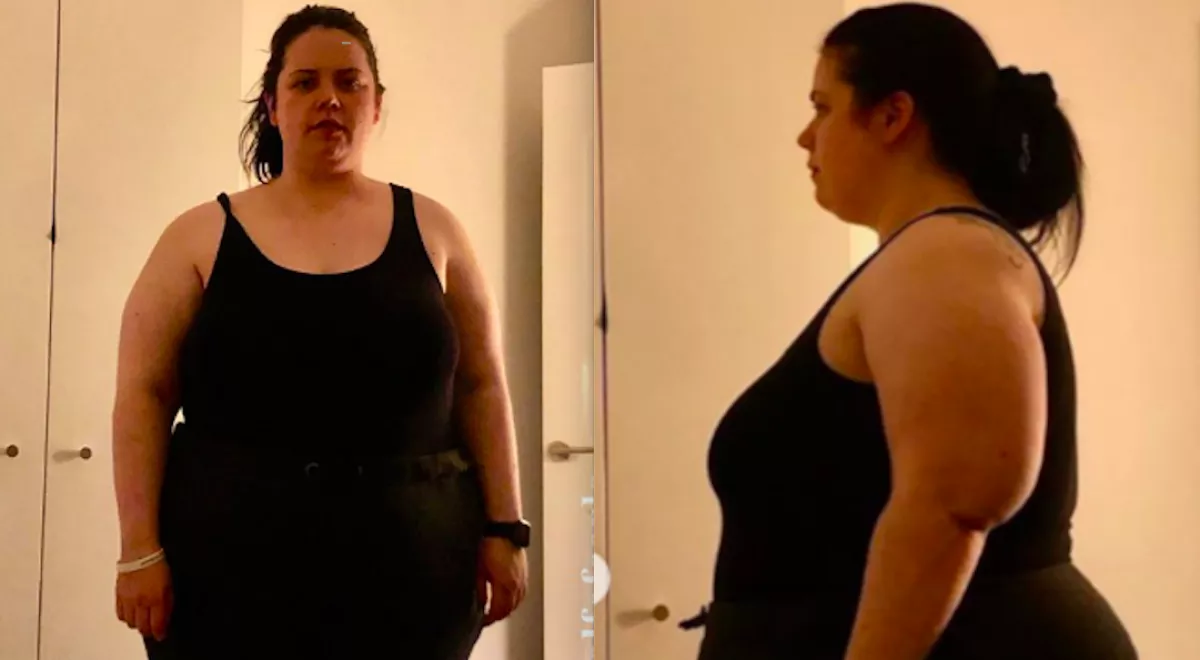 Nádszálvékonyra fogyott a 147 kilós nő: keserű, amit erről mond - Fotók