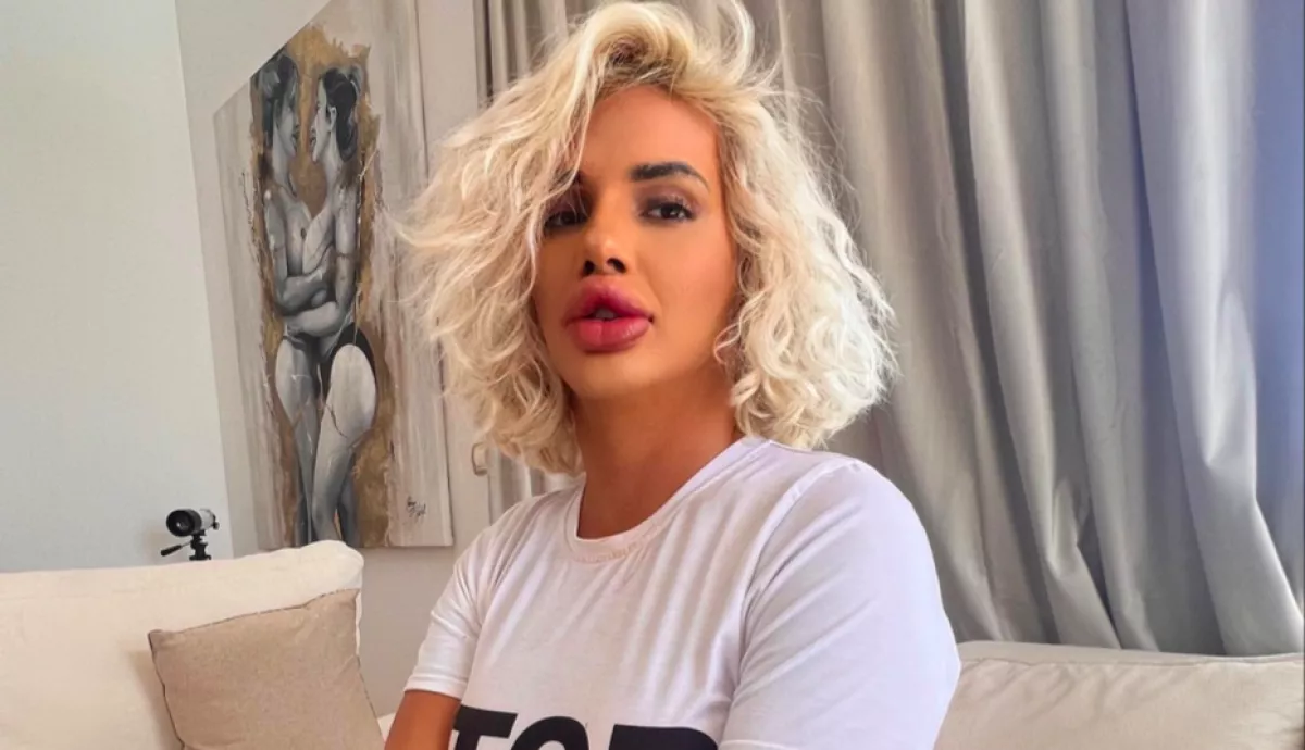 Bécsi Kolbász: enni is alig tud a gigaajkai miatt az influenszer - Fotók