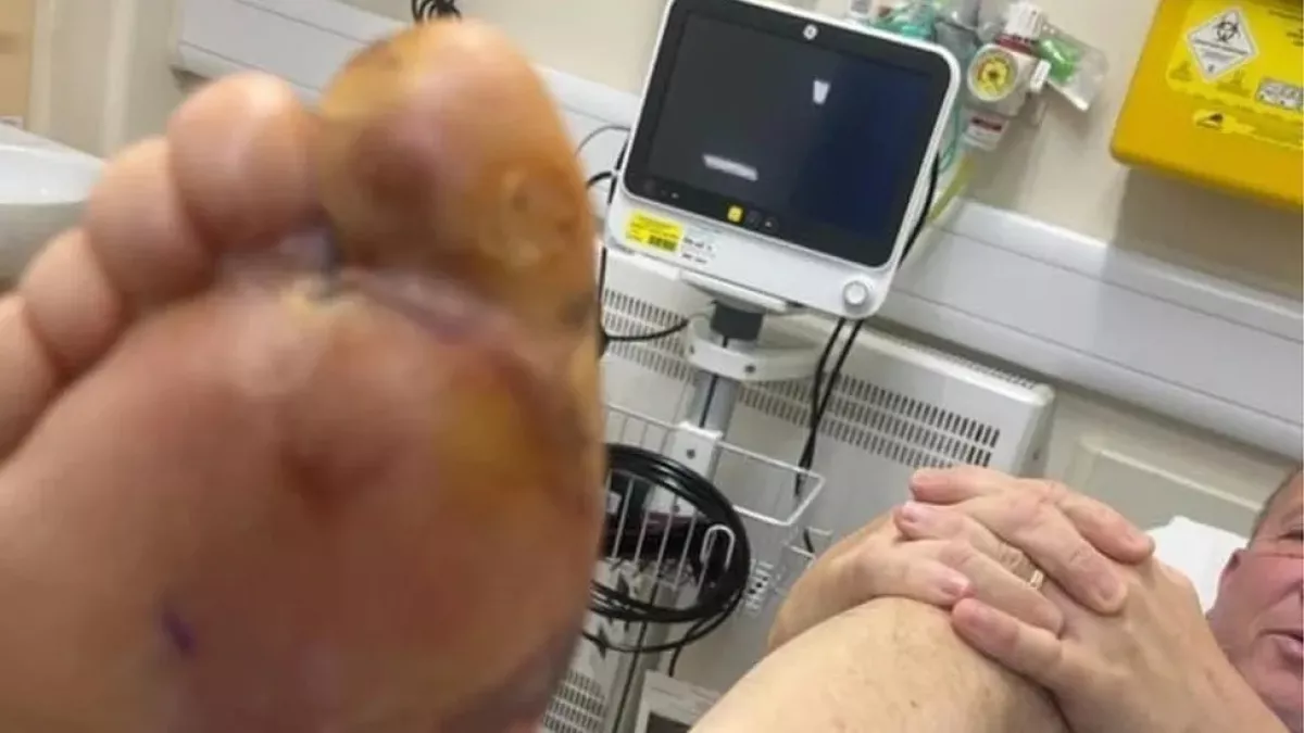 Pók harapta meg a férfit a hajókázás közben: gusztustalan, ami ezután történt - Fotó