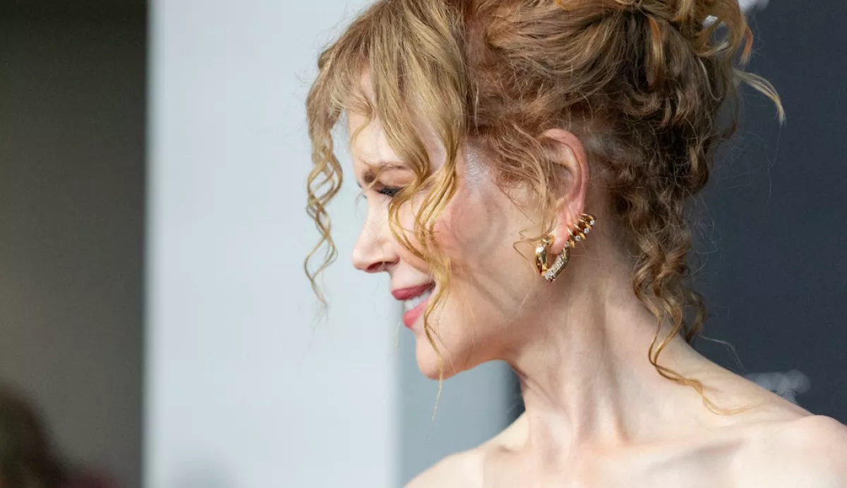Botox-csapda: így megváltozott Nicole Kidman - Fotók