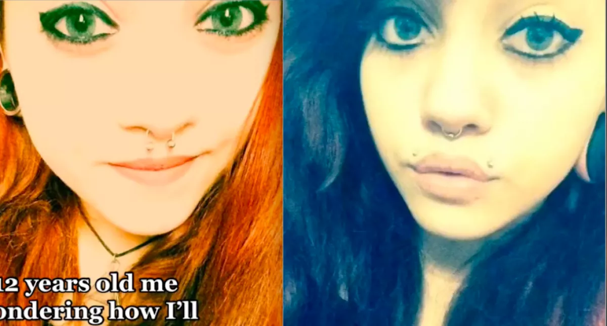 Házimacskává akarja operáltatni magát a fiatal lány: így néz ki 20 műtét után - Videók