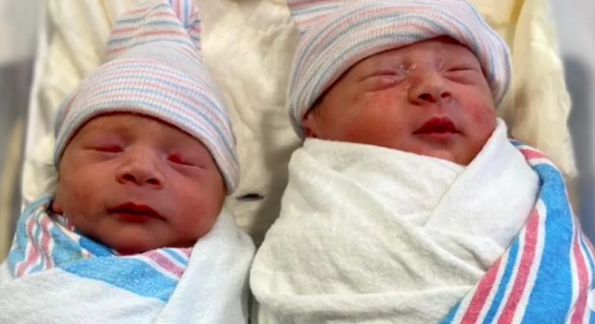 A szülők sem hitték el: páratlan ennek az ikerpárnak a születése - Fotók