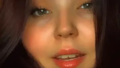 "Találkozunk a túloldalon" - Elfuserált fogyókúrás műtétbe halt bele a 20 éves lány - Videó