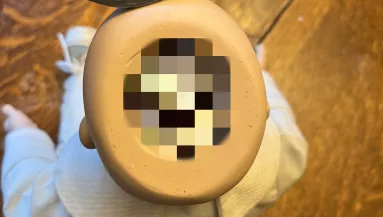 Egy babát vett a turkálóban a nő: a fejében egy bizarr meglepetésre bukkant - Fotók