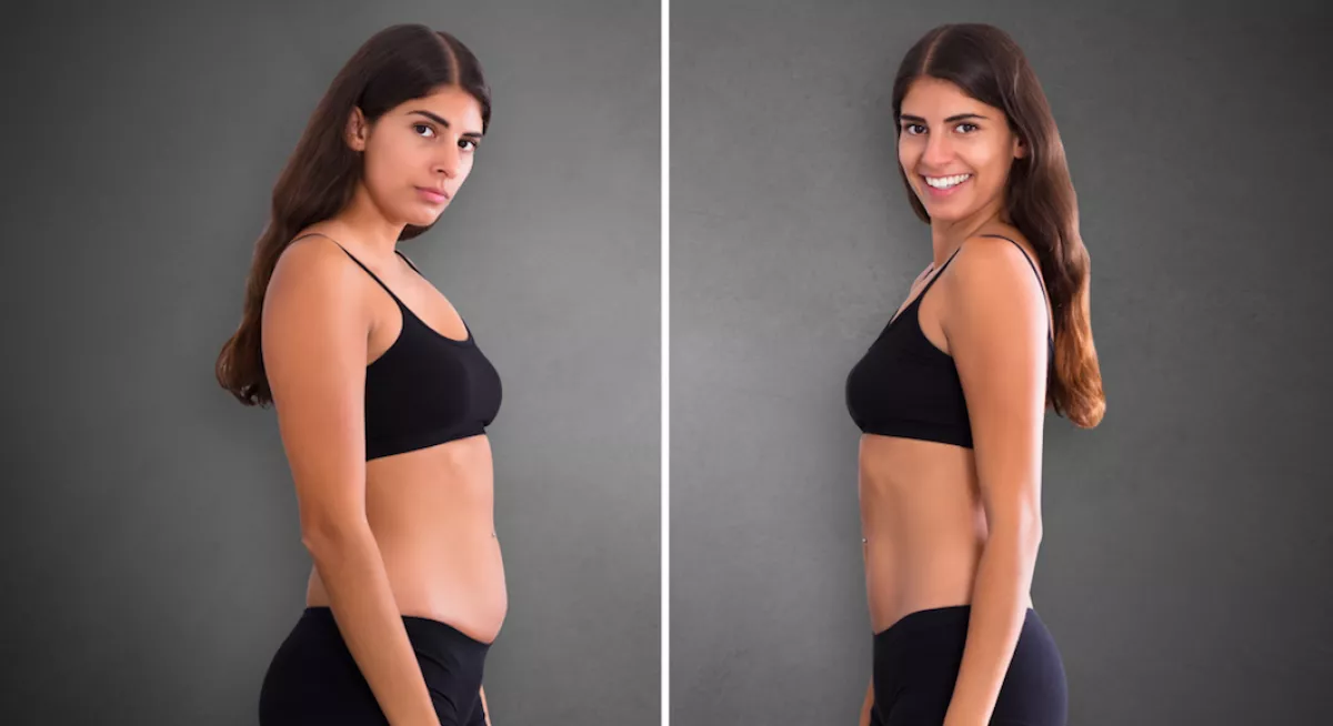 Leolvad a hasadról a zsír, ha ezt az egy ételtípust száműzöd at étrendedből