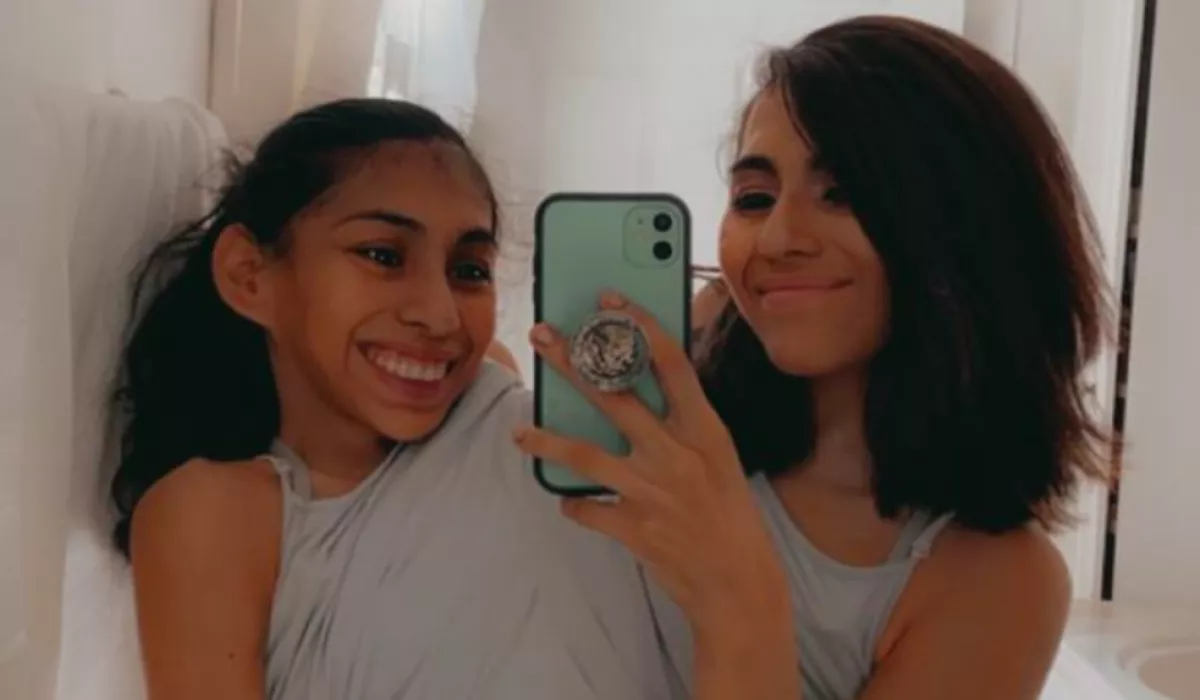 Válaszoltak a kérdésre a sziámi ikrek: Mi van, ha az egyikük meghal? - Fotók