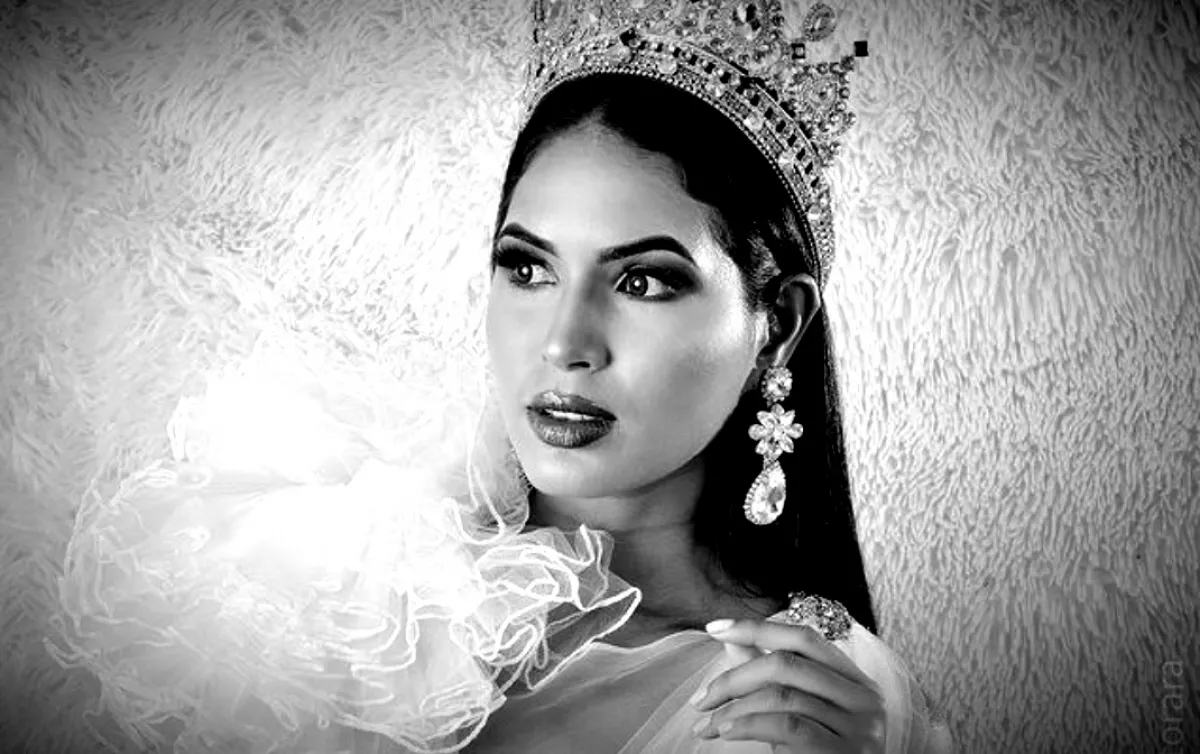 Belehalt a rutinműtétbe a 24 éves szépségkirálynő - Fotók