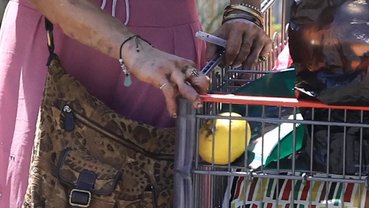 Sokkoló képek: rohad a keze, a foga a 41 éves szupermodellnek - Ebédet guberál egy kukában