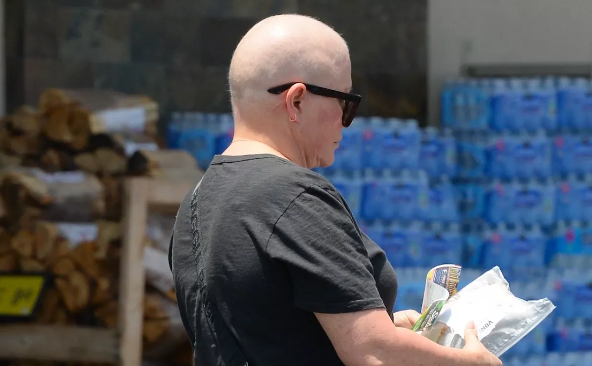 Haja sincs már: az életéért küzd a Baywatch bombázója - Fotók