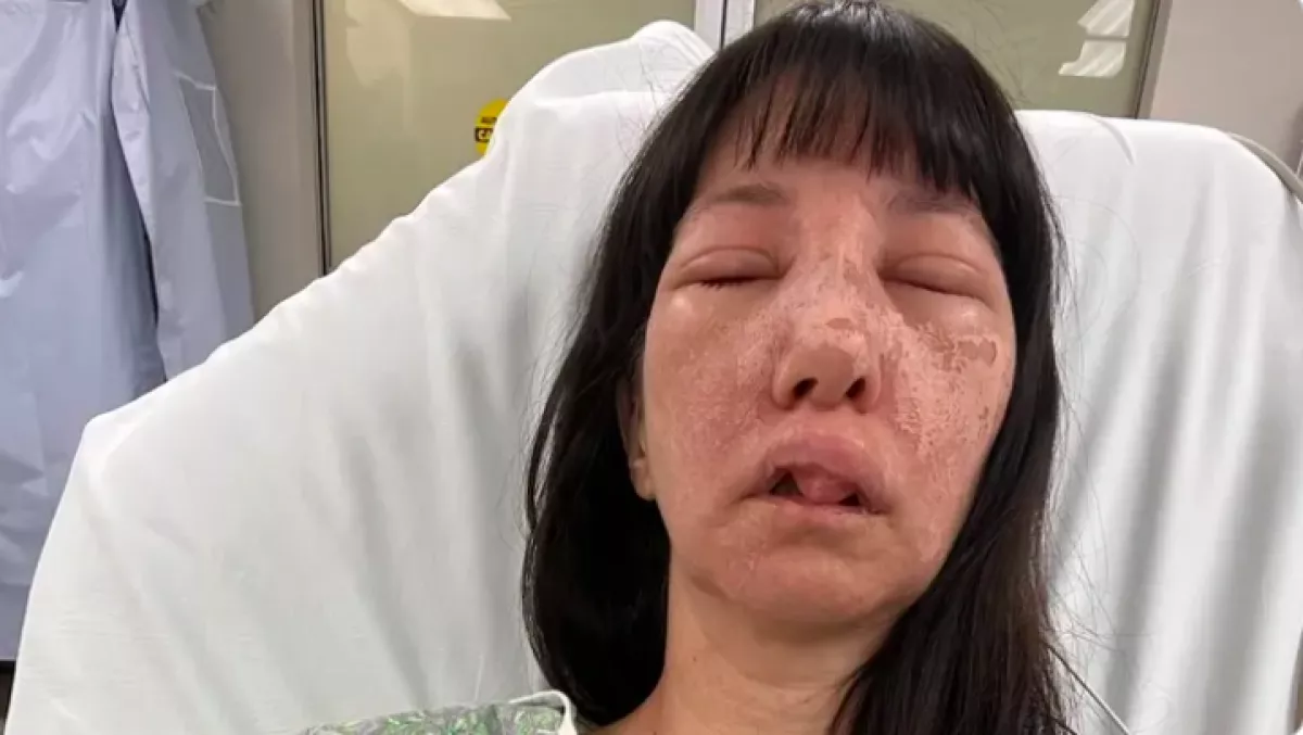 Szemkárosodás, kiütések, fájdalom: kórházba került a nő, akit megmart egy pók - Fotók