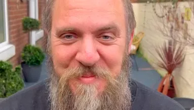 Szégyellte a kopasz fejét a 41 éves Dominik: nem sokkal később minden nő álma lett - Videó