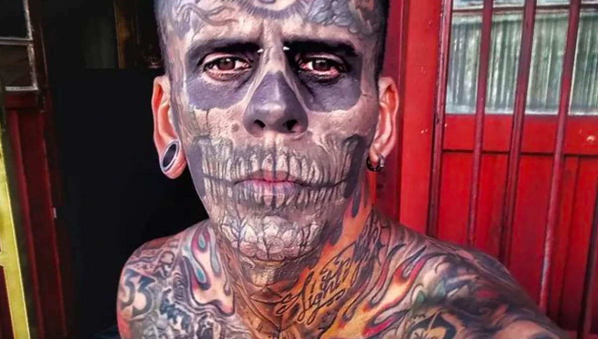 El akarta tüntetni a tetkóit a totál kivarrt fickó: így néz ki a sokadik kezelés után - Fotók