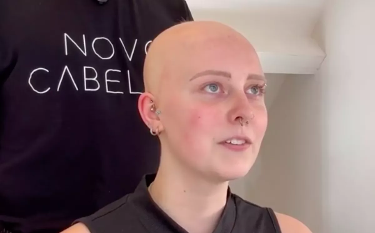 Betegség miatt lett kopasz a 18 éves lány: amit a fodrász tett vele, maga a csoda - Videó