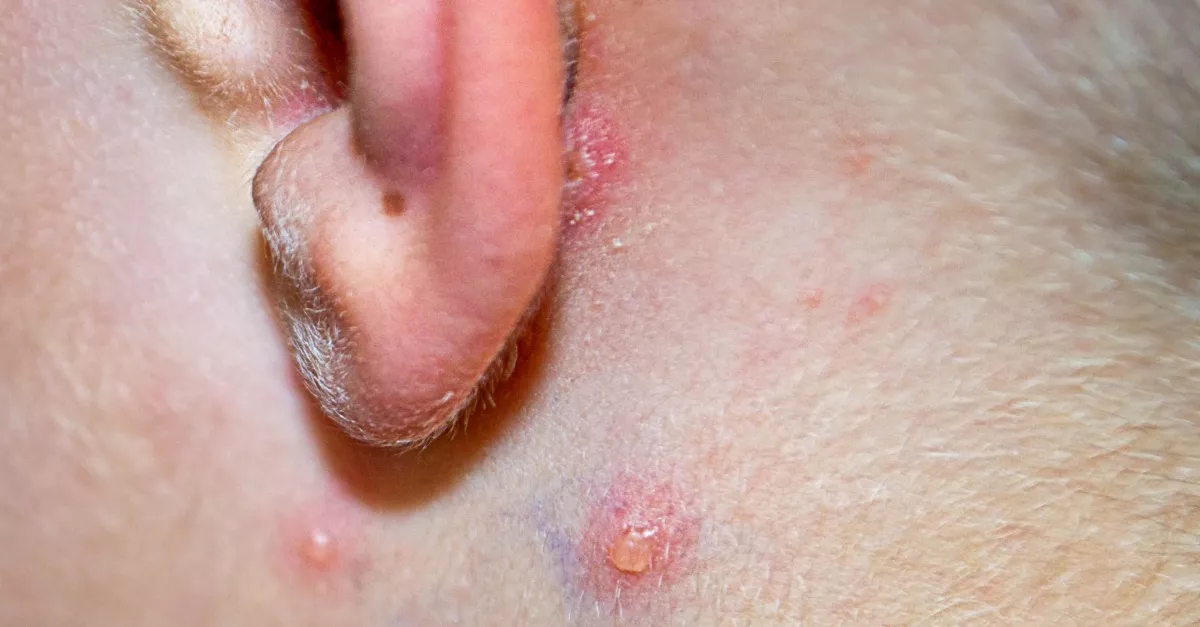 20 %-kall nőtt a fertőzöttek száma: világszerte erősen terjed a vírus