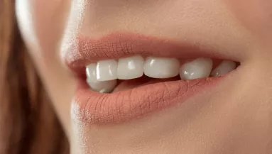 Mit jelent a fogbeültetés? Hogyan történik? Ezt kell tudnod!