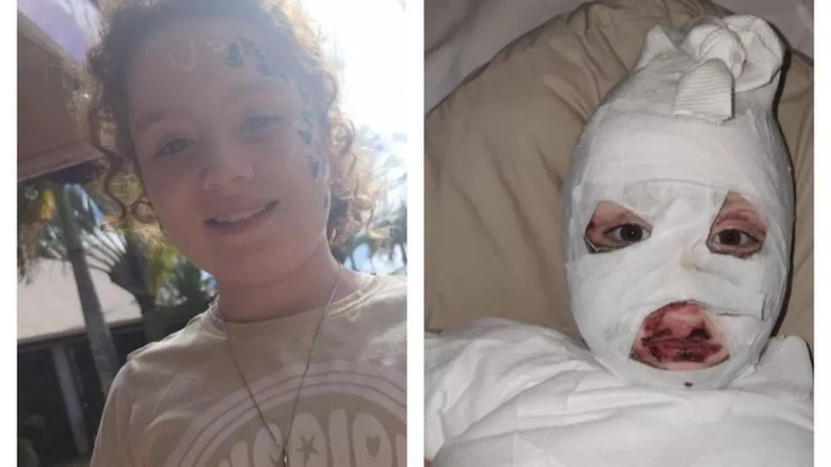Súlyos égési sérüléseket szenvedett a 8 éves Daniella egy Temu pulóver miatt - Visszahívták - Fotók