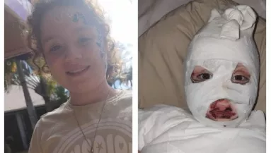 Súlyos égési sérüléseket szenvedett a 8 éves Daniella egy Temu pulóver miatt - Visszahívták - Fotók