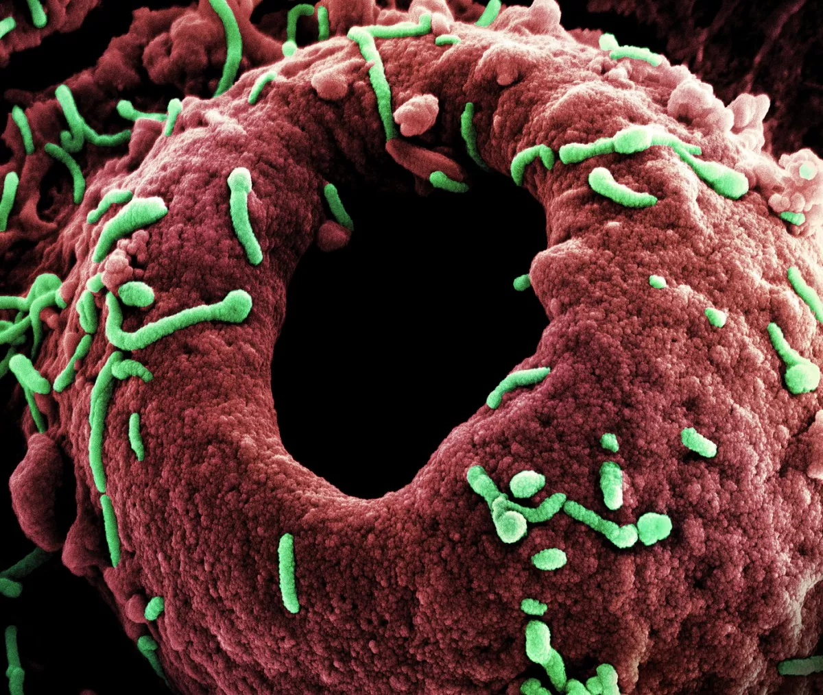 WHO-riasztás: 89 %-ban halálos - új vírus terjed Afrikában
