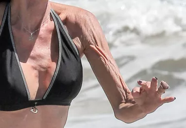 Tönkrevágta a plasztika a szupermodell egész életét - Megrázó így látni őt - Fotók