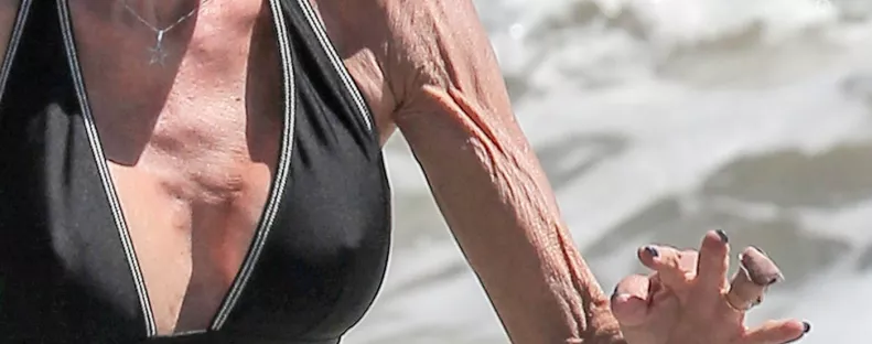 Tönkrevágta a plasztika a szupermodell egész életét - Megrázó így látni őt - Fotók