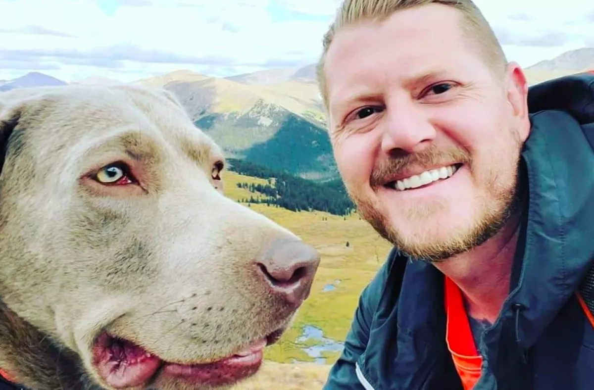 Megégette a hüvelykujját a férfi: néhány nap múlva elvesztette a lábait - Fotó