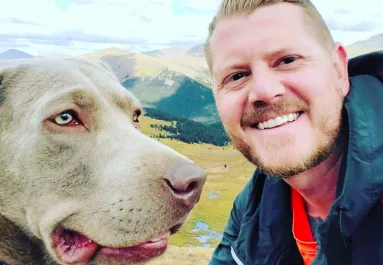 Megégette a hüvelykujját a férfi: néhány nap múlva elvesztette a lábait - Fotó