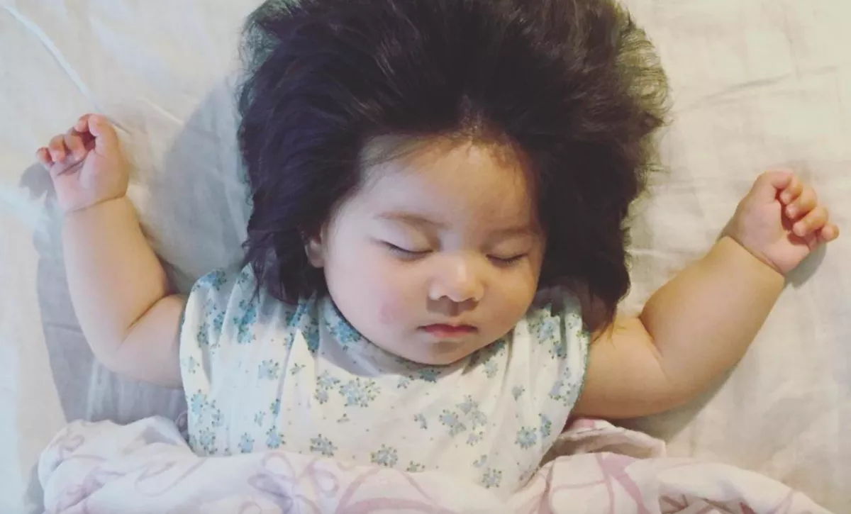 Emlékszel a világ leghajasabb kisbabájára? Így néz ki 7 évesen - Fotók