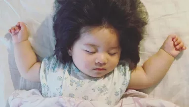 Emlékszel a világ leghajasabb kisbabájára? Így néz ki 7 évesen - Fotók