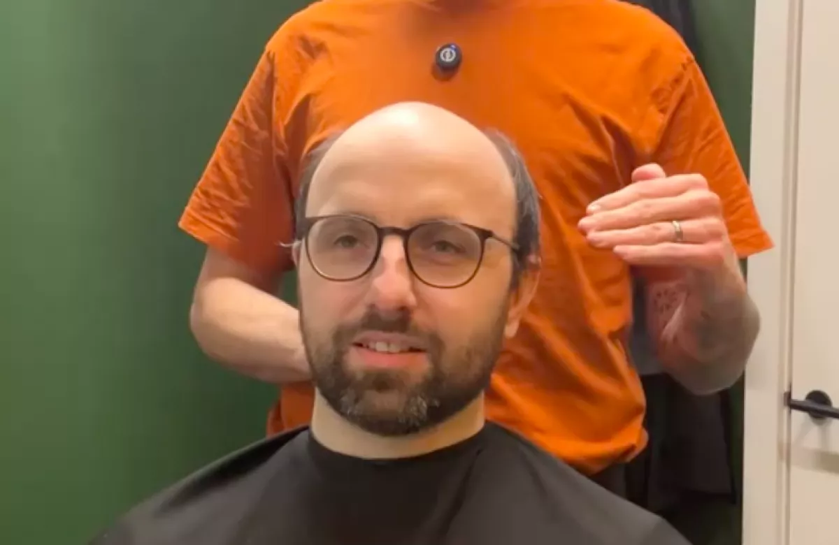 20 év után kíváncsi a kopasz férfi, hogy néz ki hajjal: az eredmény sokkolja - Videó