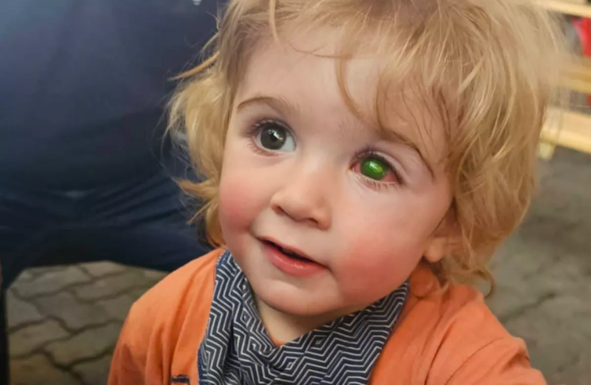 Vírus a látószervén: egy puszi miatt veszti el a látását a 2 éves kisfiú? - Fotók