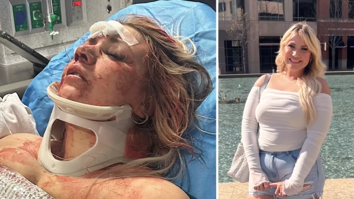 Sokk a lánybúcsún: véresen, eszméletlenül került kórházba a menyasszony - Fotók