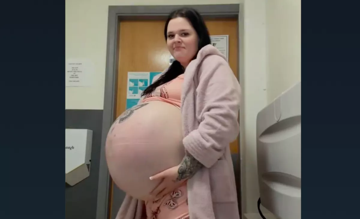 Ritka betegség miatt lett óriási a kismama pocakja: így néz ki a babája - Videók