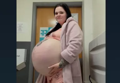 Ritka betegség miatt lett óriási a kismama pocakja: így néz ki a babája - Videók