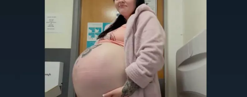 Ritka betegség miatt lett óriási a kismama pocakja: így néz ki a babája - Videók