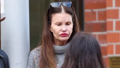 Megrázó képek: íme 6 sztár, akit legyőzött a botox - Fotók