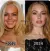 botox, Hollywood, plasztika, sztárok, 