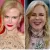 botox, Hollywood, plasztika, sztárok, 