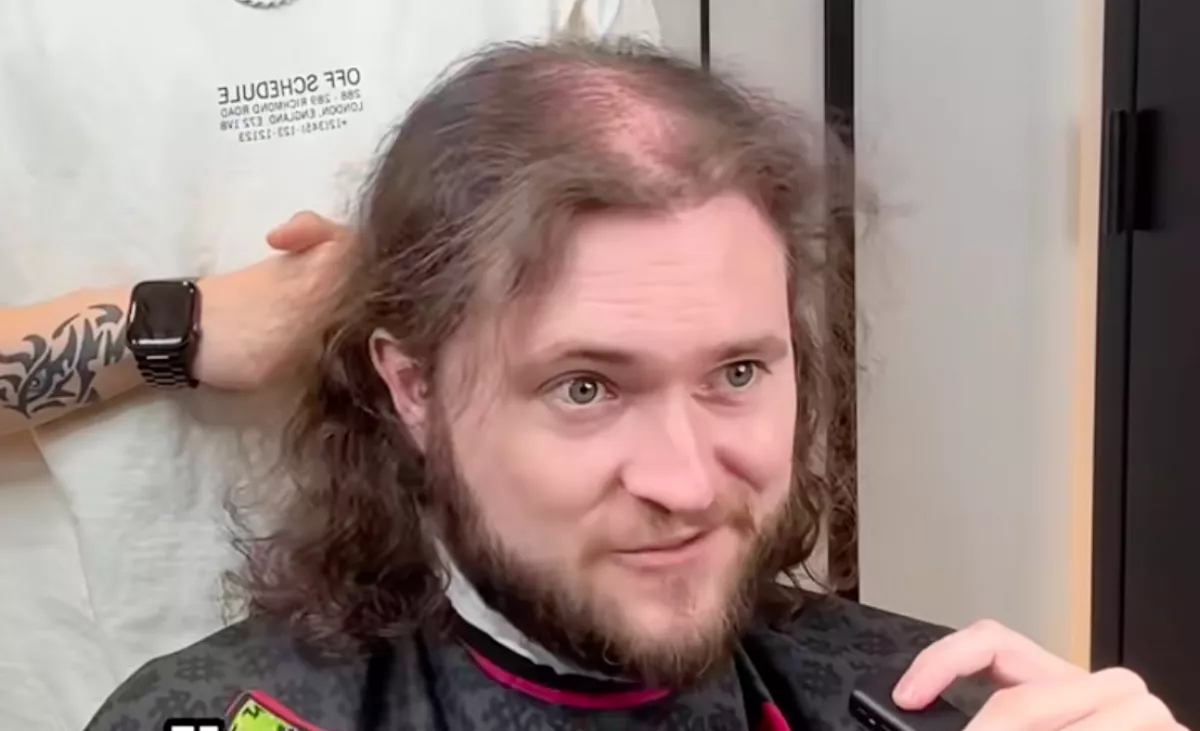 Kopasz akar lenni a hajhullása miatt: amit a fodrász csinál belőle, sokkolja - Videó