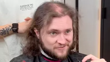 Kopasz akar lenni a hajhullása miatt: amit a fodrász csinál belőle, sokkolja - Videó