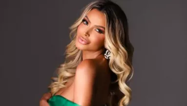 350 milliót költött plasztikára: kidobták a randi-appból, mert "túl szép" - Fotók