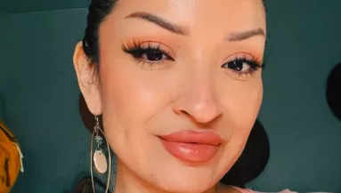 Élete álma teljesült az orrműtéttel: amikor meglátja a végeredményt, elakad a szava - Videó