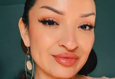 Élete álma teljesült az orrműtéttel: amikor meglátja a végeredményt, elakad a szava - Videó