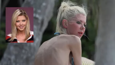 Kate Beckinsale és a többiek: 5 sztár, akit legyőzött az anorexia - Fotók