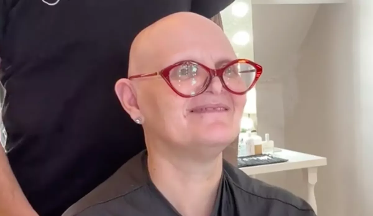 Dús hajra vágyik a kopasz nő: az új frizurája nem csak őt sokkolja - Videó