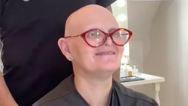 Dús hajra vágyik a kopasz nő: az új frizurája nem csak őt sokkolja - Videó