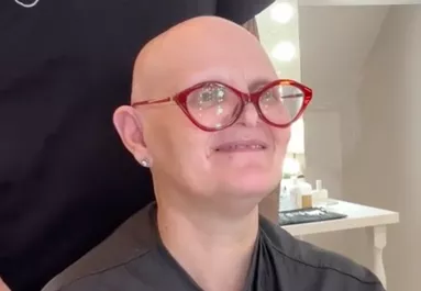 Dús hajra vágyik a kopasz nő: az új frizurája nem csak őt sokkolja - Videó