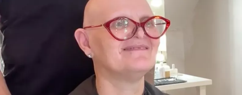 Dús hajra vágyik a kopasz nő: az új frizurája nem csak őt sokkolja - Videó