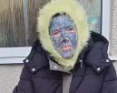 Leszedték az anya arctetkóit: sokkot kaptak a gyerekei, amikor meglátták - Fotók
