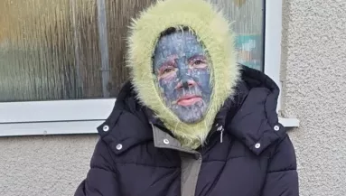 Leszedték az anya arctetkóit: sokkot kaptak a gyerekei, amikor meglátták - Fotók