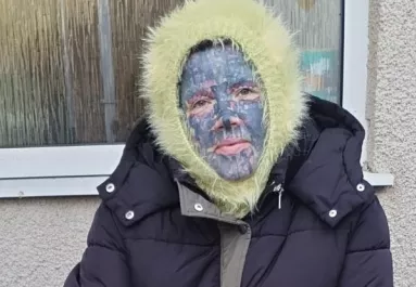 Leszedték az anya arctetkóit: sokkot kaptak a gyerekei, amikor meglátták - Fotók